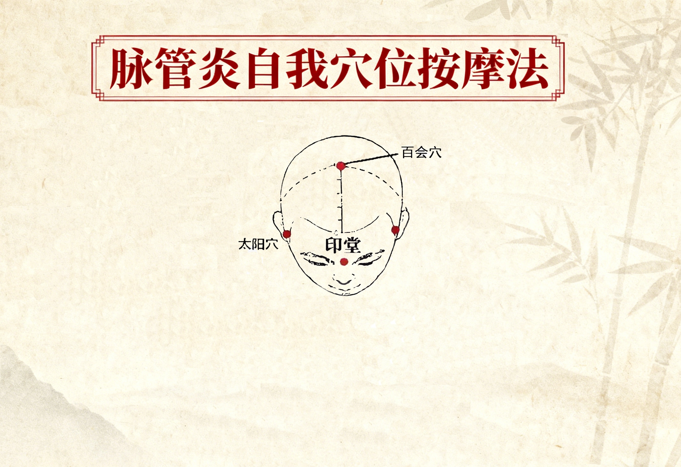 我院研究制定的“脉管炎自我穴位按摩法”